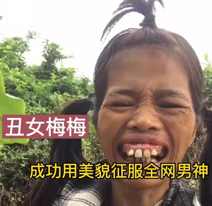 广东女子因长相奇特成大网红,一口龅牙无处安放,网友抢着要娶她