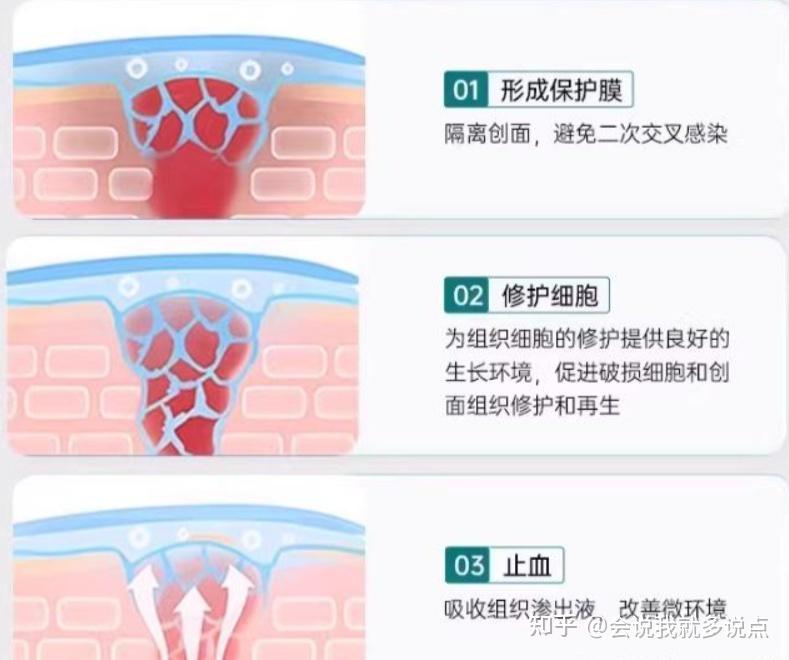 痔疮的小肉球真的下不去吗? - 知乎