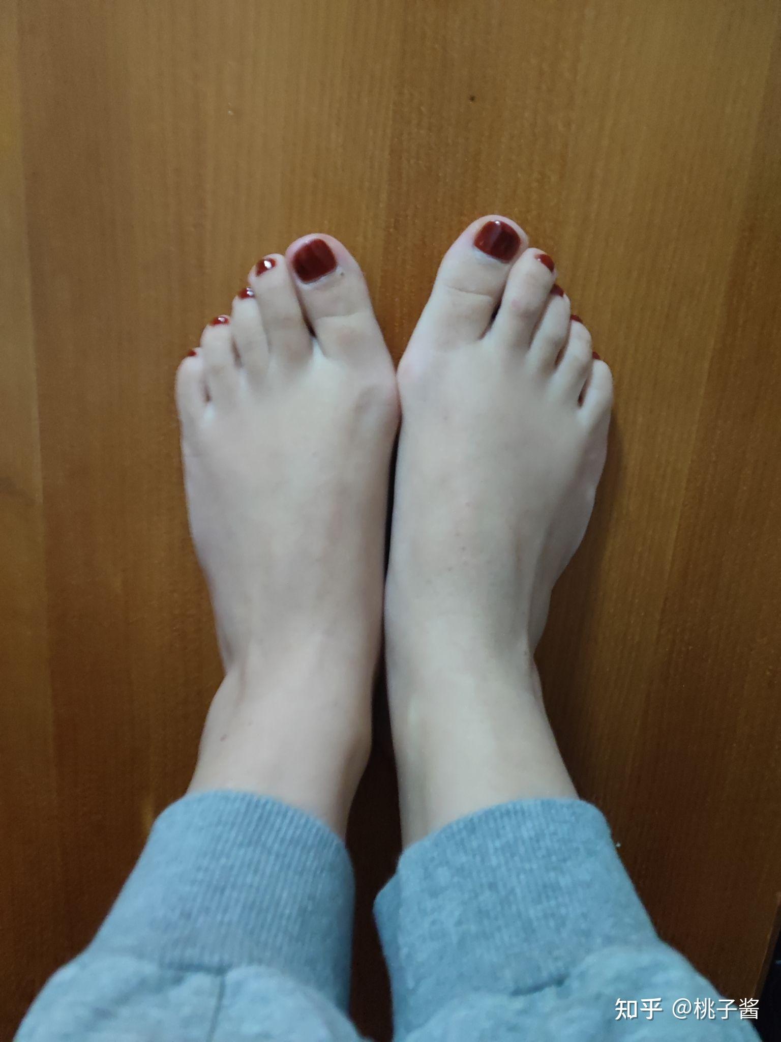 脚趾大拇指外翻什么原因?如何调节? - 知乎