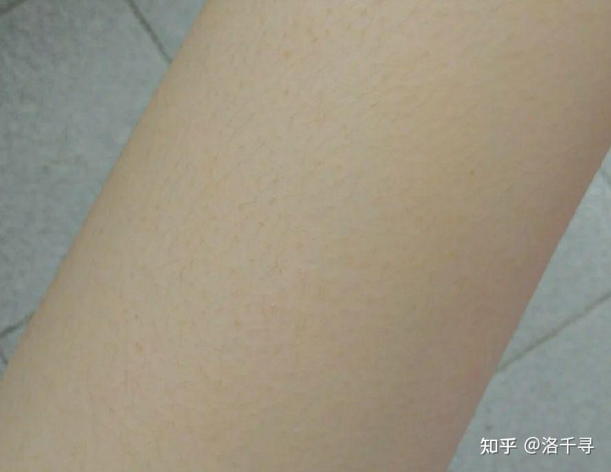 鸡皮肤用什么能遮住(鸡皮肤用什么能遮住呢)