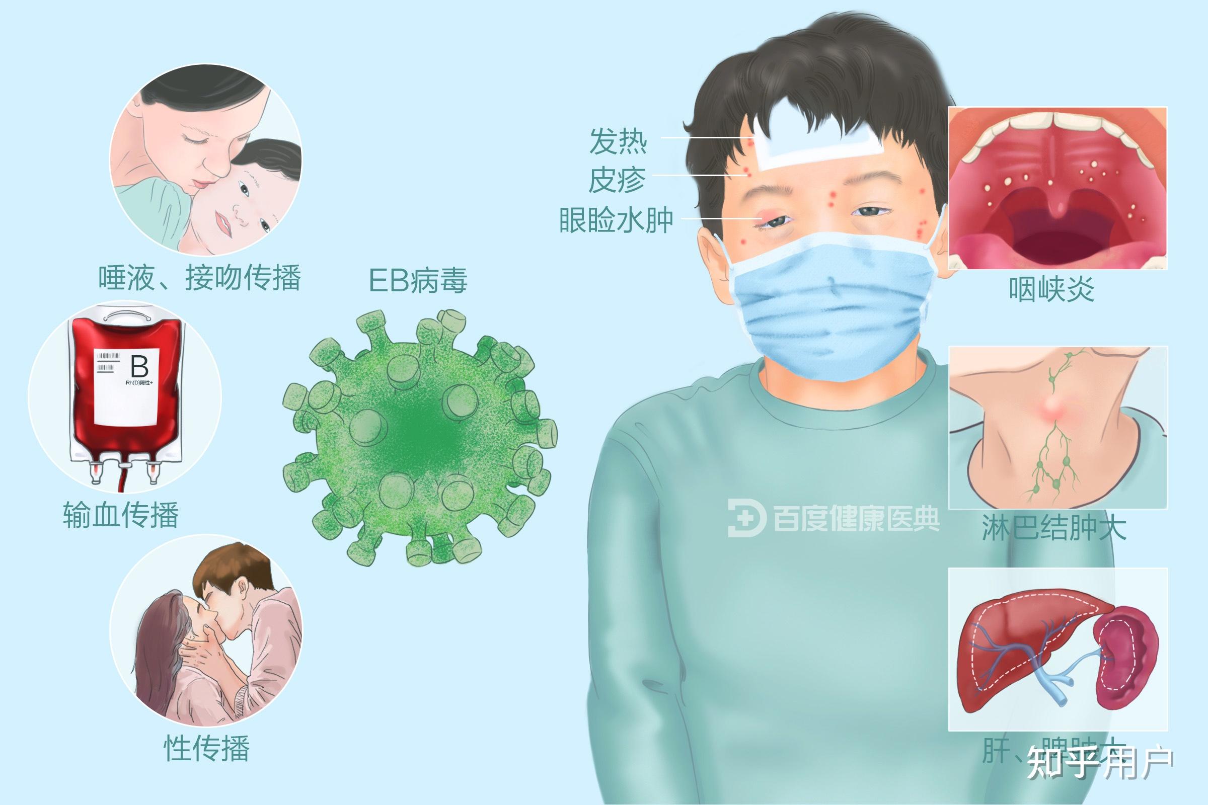  最近流行什么病毒感染(最近流行啥病毒)