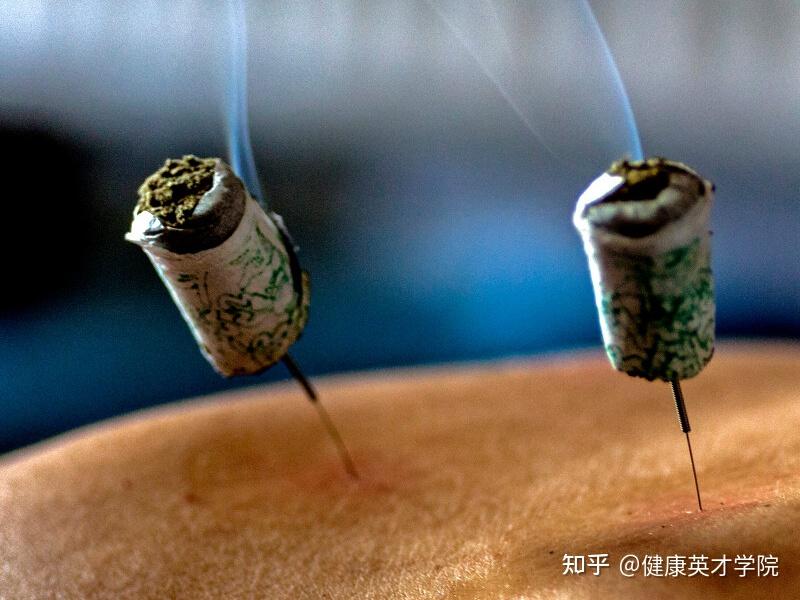 艾绒/艾柱/艾条,你用什么进行艾灸?施灸材料的正确打开方式! - 知乎