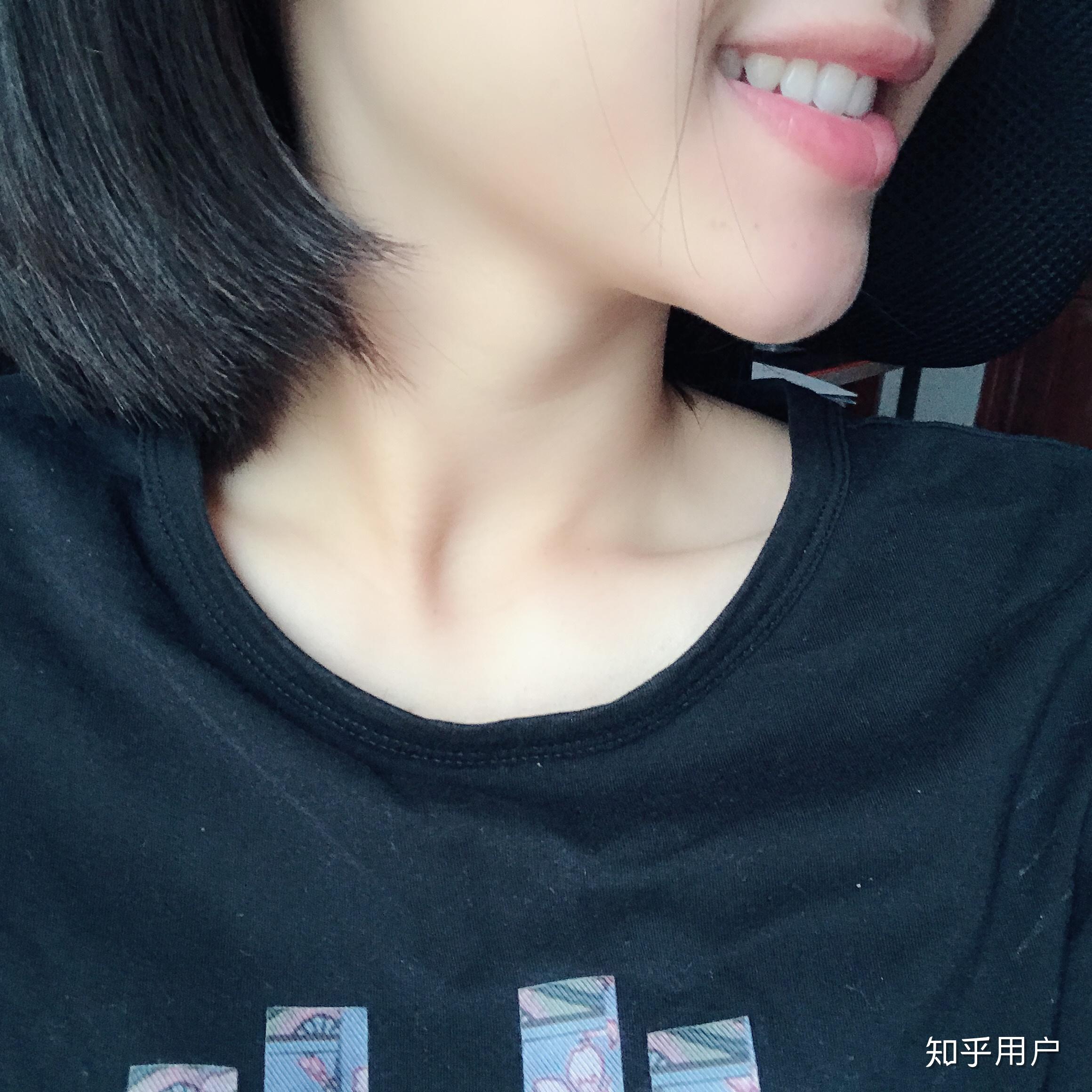 牙齿整齐但感觉牙齿外凸导致嘴突嘴唇有些外翻请问可以通过带牙套正畸