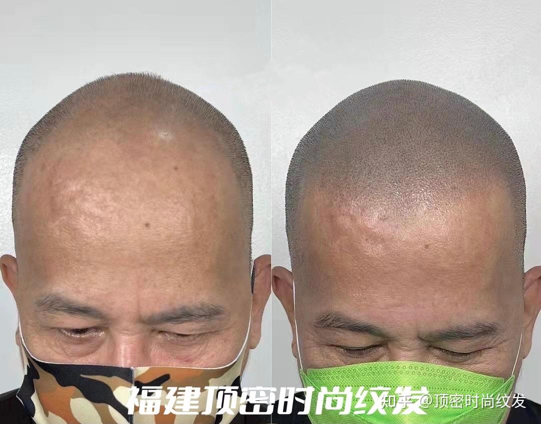 大s老公具俊晔的头发是纹的吗？纹发是什么？ - 知乎