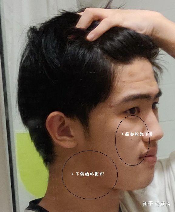 为什么我的脸轮廓这么扁平? - 知乎