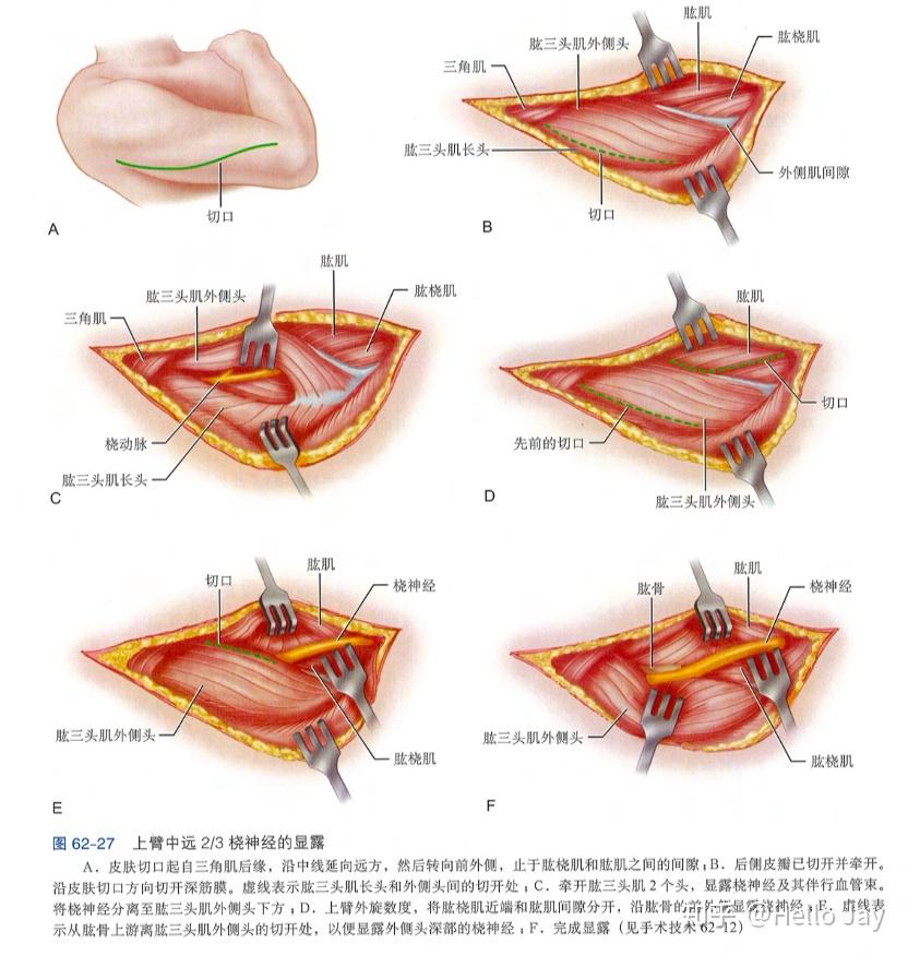 第十三节 臂丛神经损伤