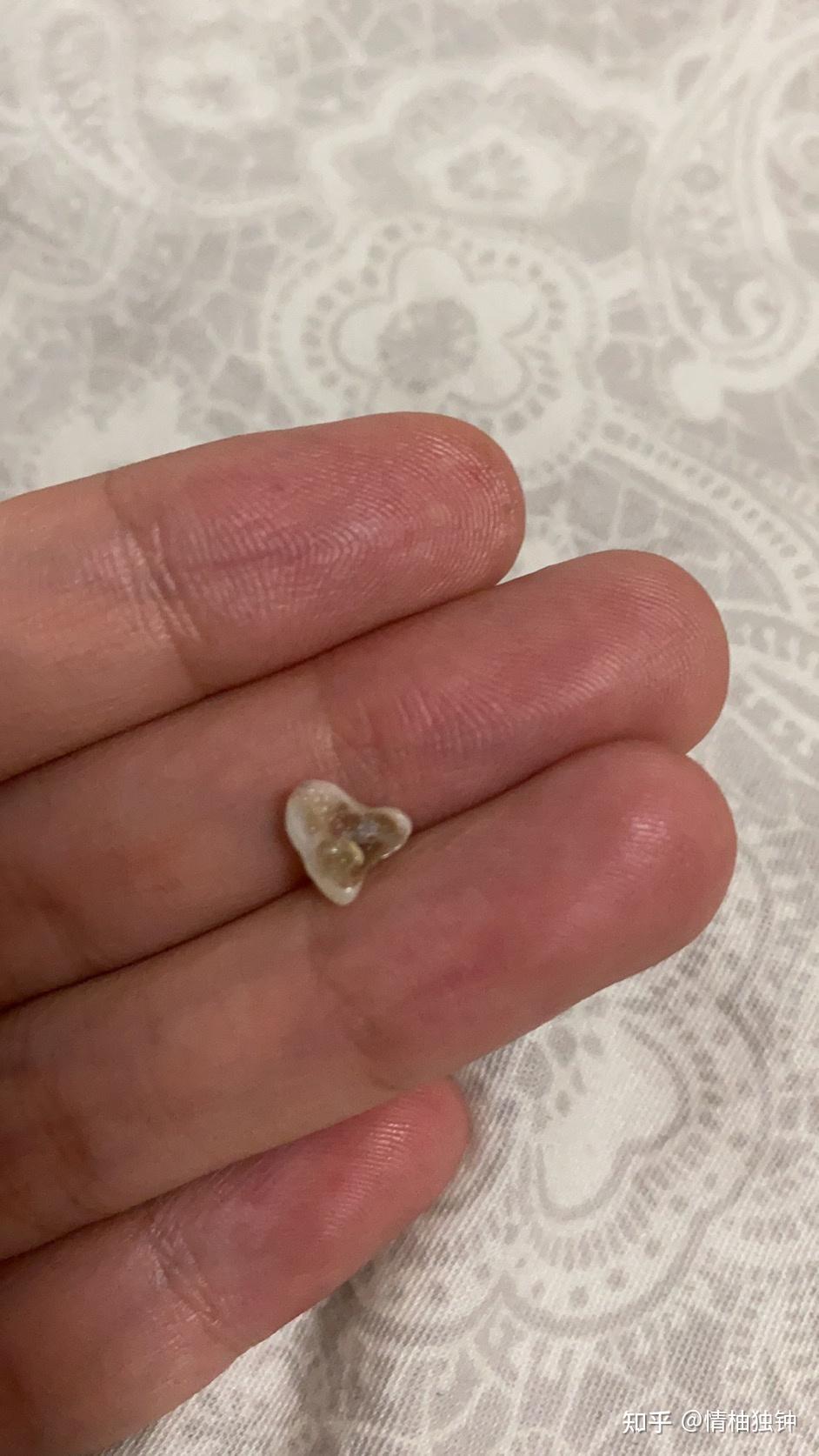 各位有收集自己狗狗换下来的乳牙的习惯吗