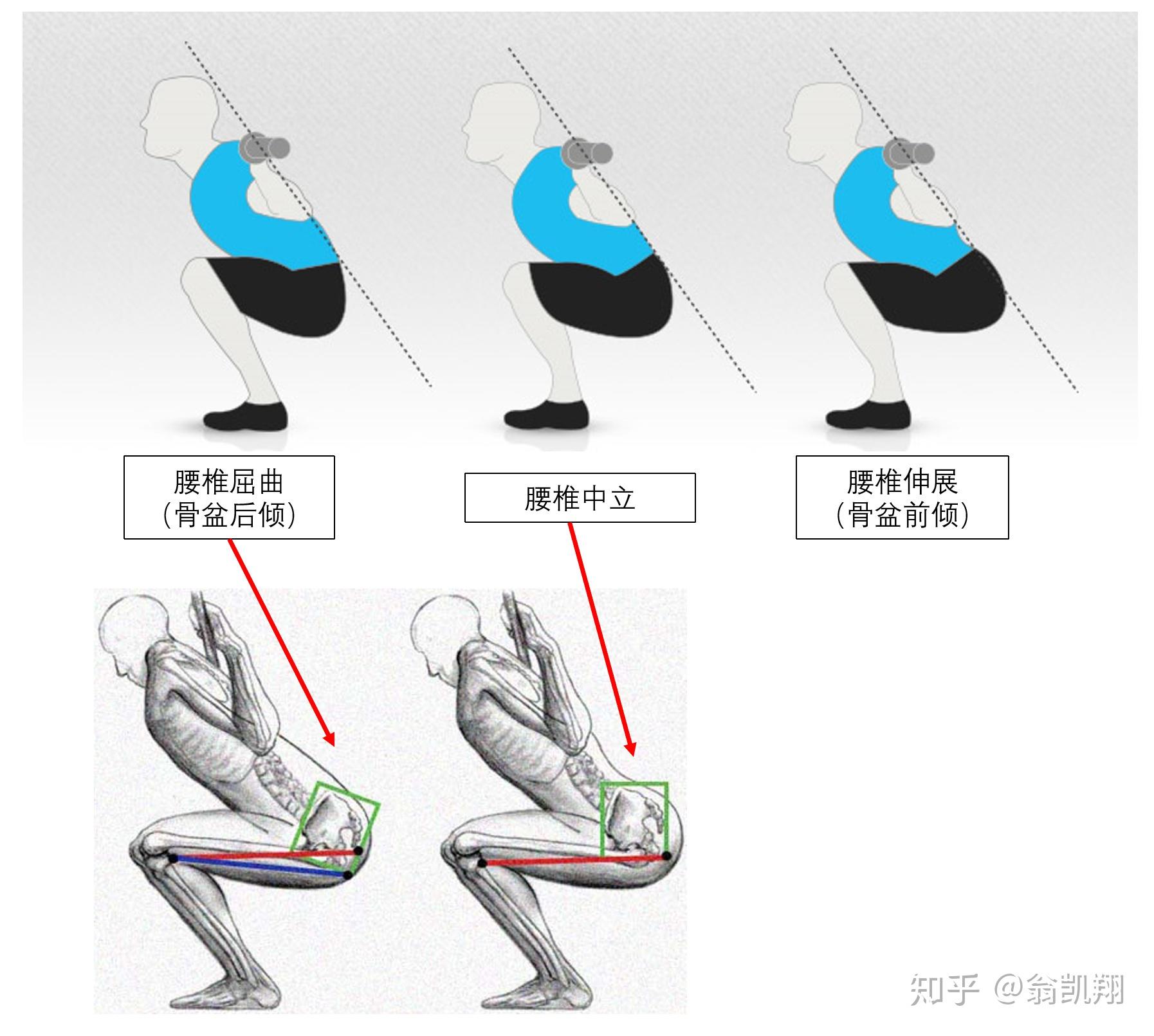 如何解决深蹲时候的屁股眨眼buttwink髋关节前屈盆骨翻转问题