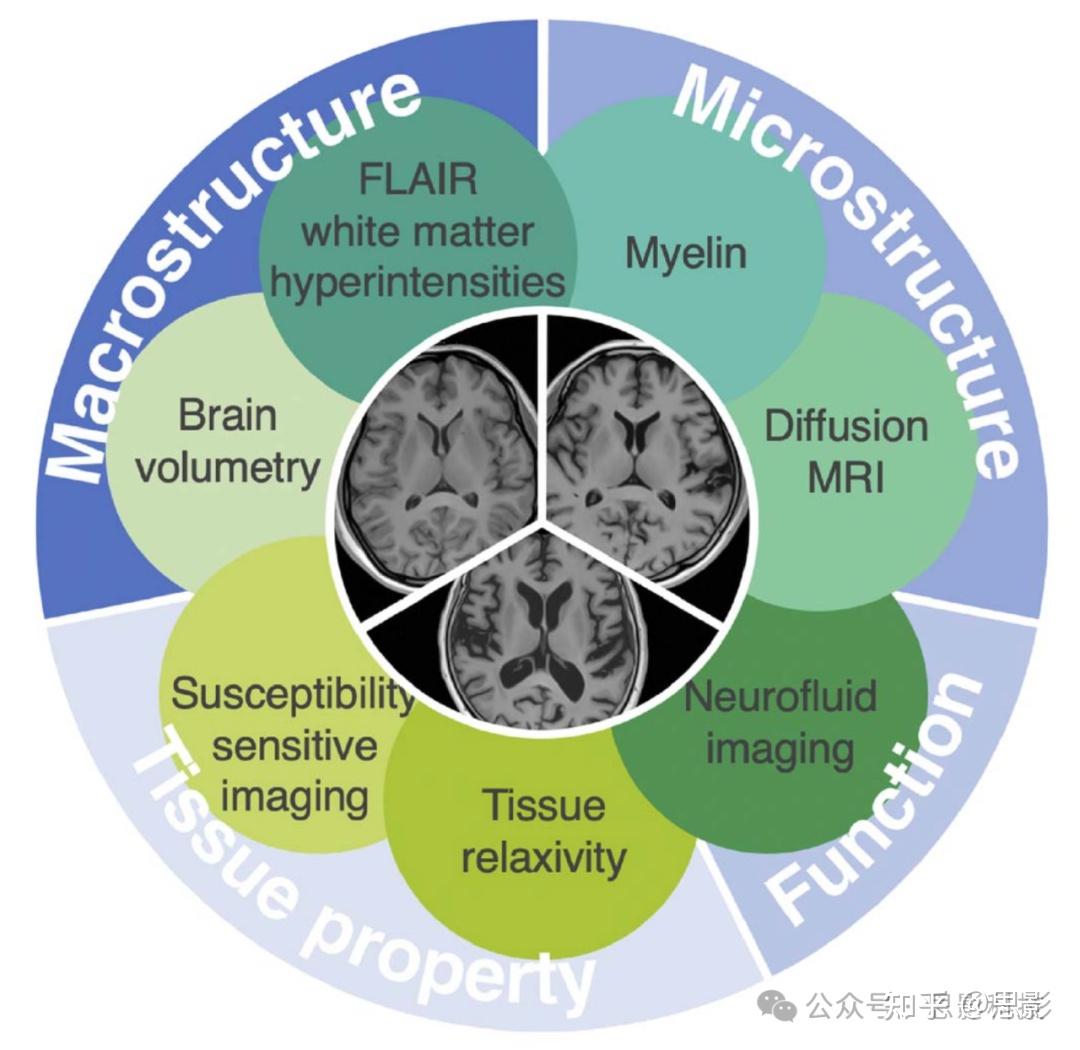 解码脑发育与衰老：来自MRI 技术的先驱性洞见- 知乎