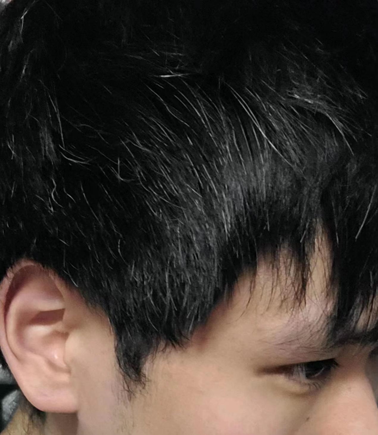 少年白(青少年长白发)怎么办? - 知乎