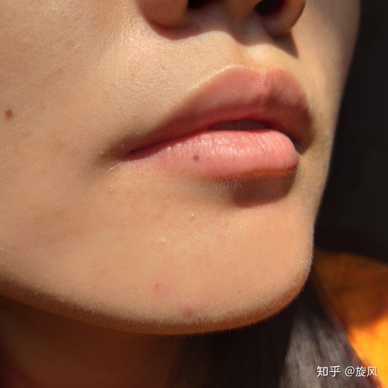 冰点脱毛仪脱唇毛效果如何? - 知乎