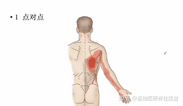 右背痛位置图图片