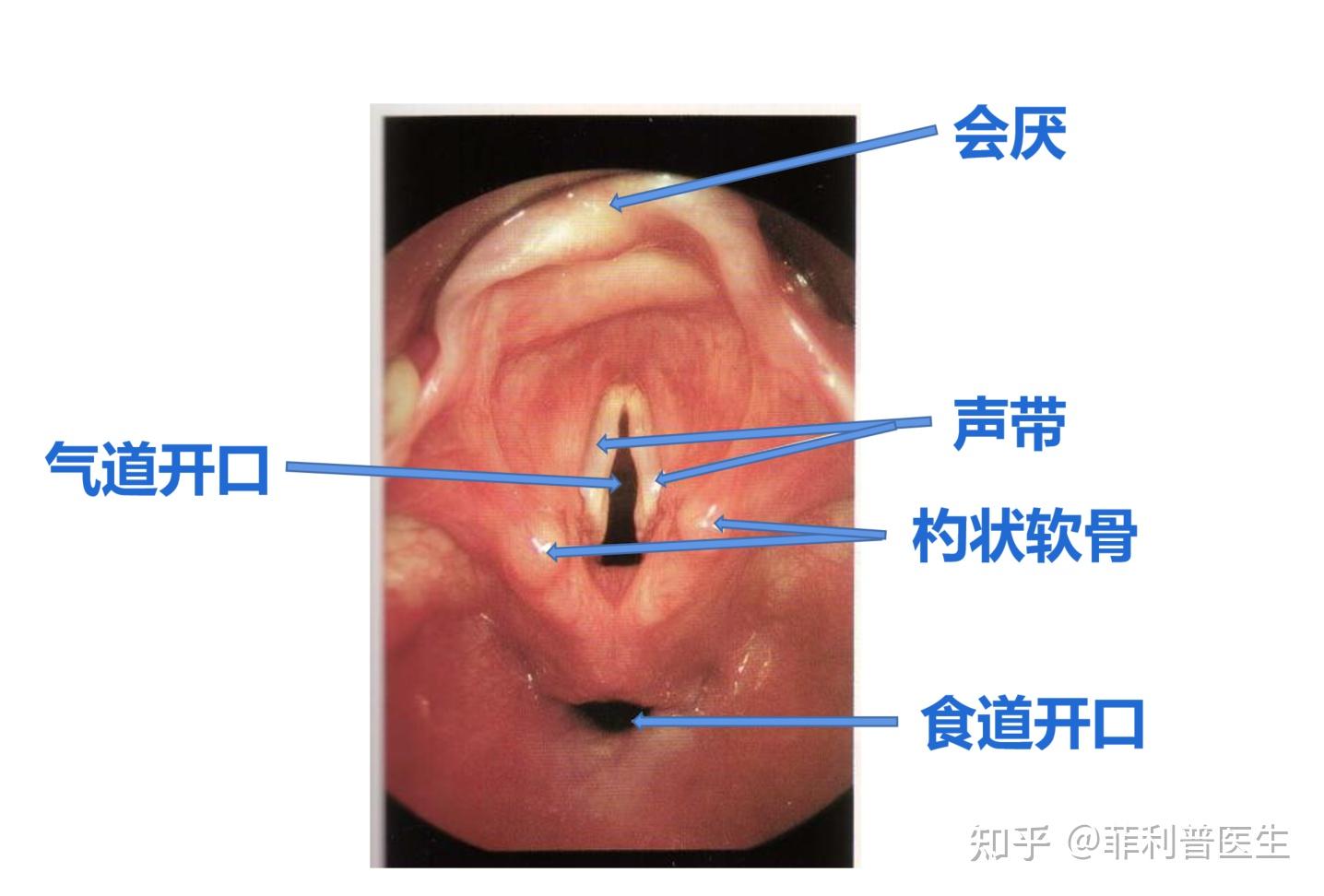 会厌反射图片