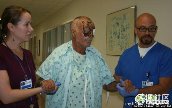 灭绝人类的丧尸病毒,阮病毒!