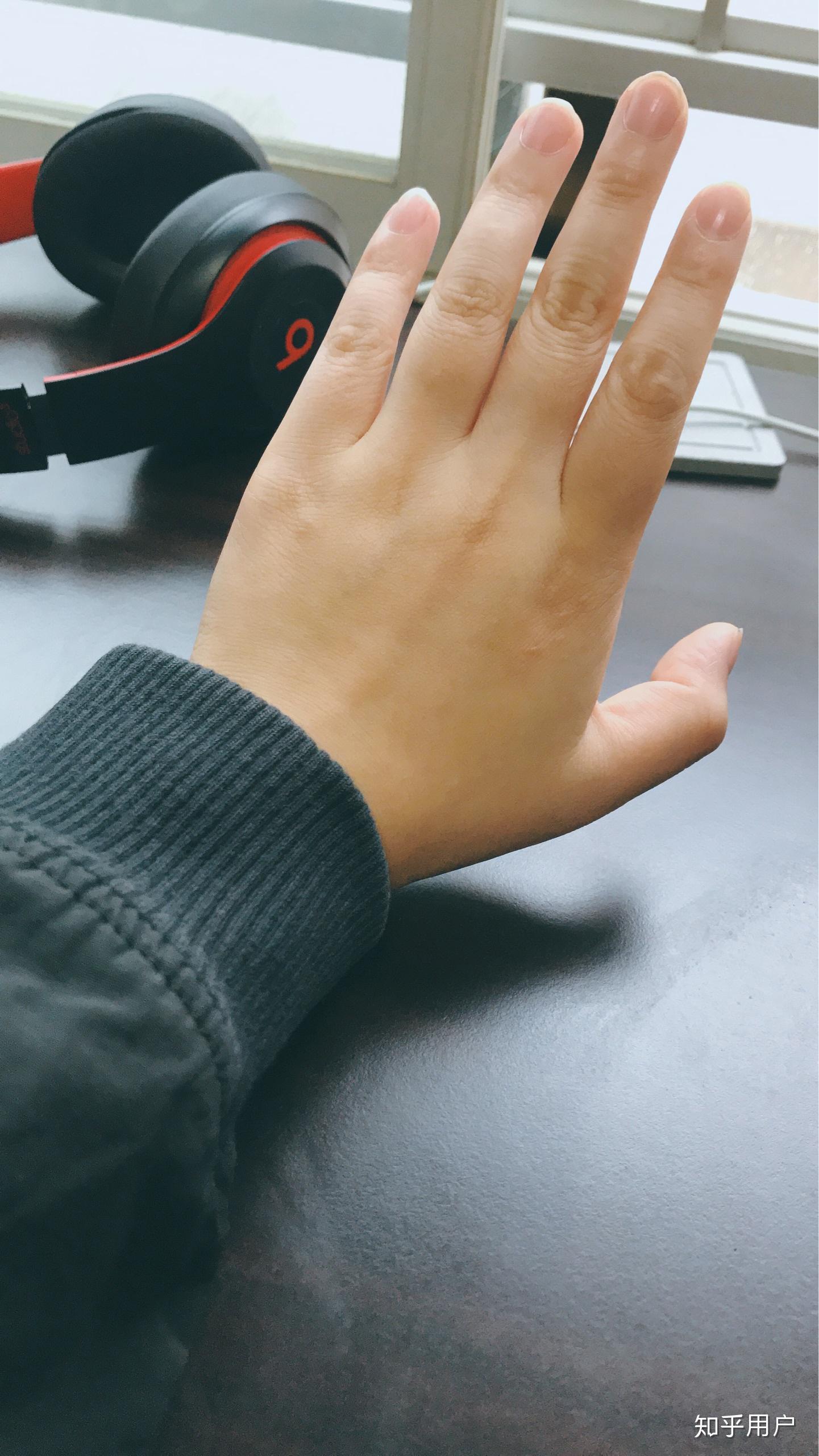 是不是每个胖子手都是胖的? - 知乎