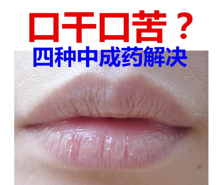 经常口苦口干,怎么办?老中医告诉你四味中成药,缓解症状很轻松 - 知乎