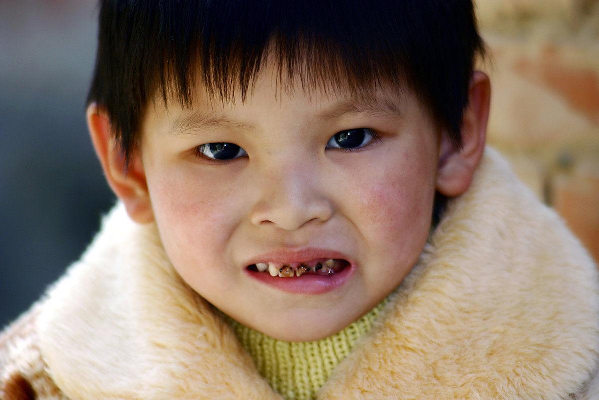 儿童乳牙也应该及时治疗-杨文智的博客-KQ88口腔博客
