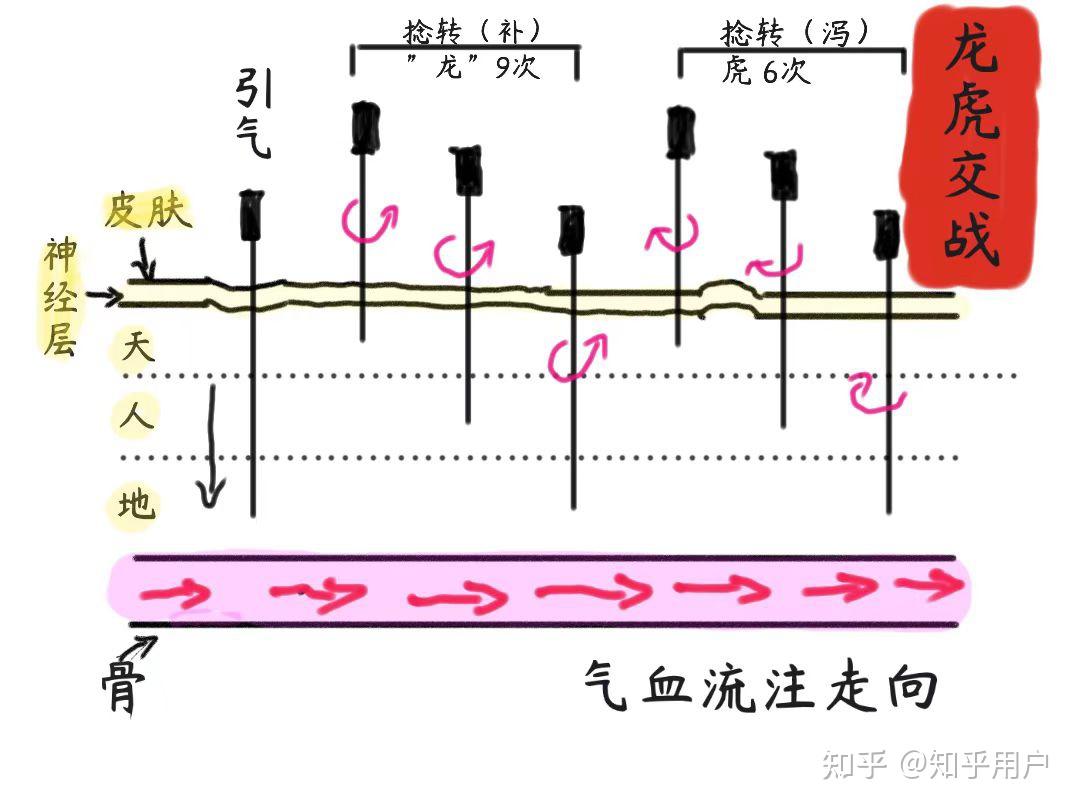 10针刺法之龙虎交战与龙虎升降、五脏交经法、呼吸补泻法、子午捣臼法、十二经络病之治疗法则、下针八法、五俞穴治疗、原络治疗法、俞募治疗法、会郄 ...