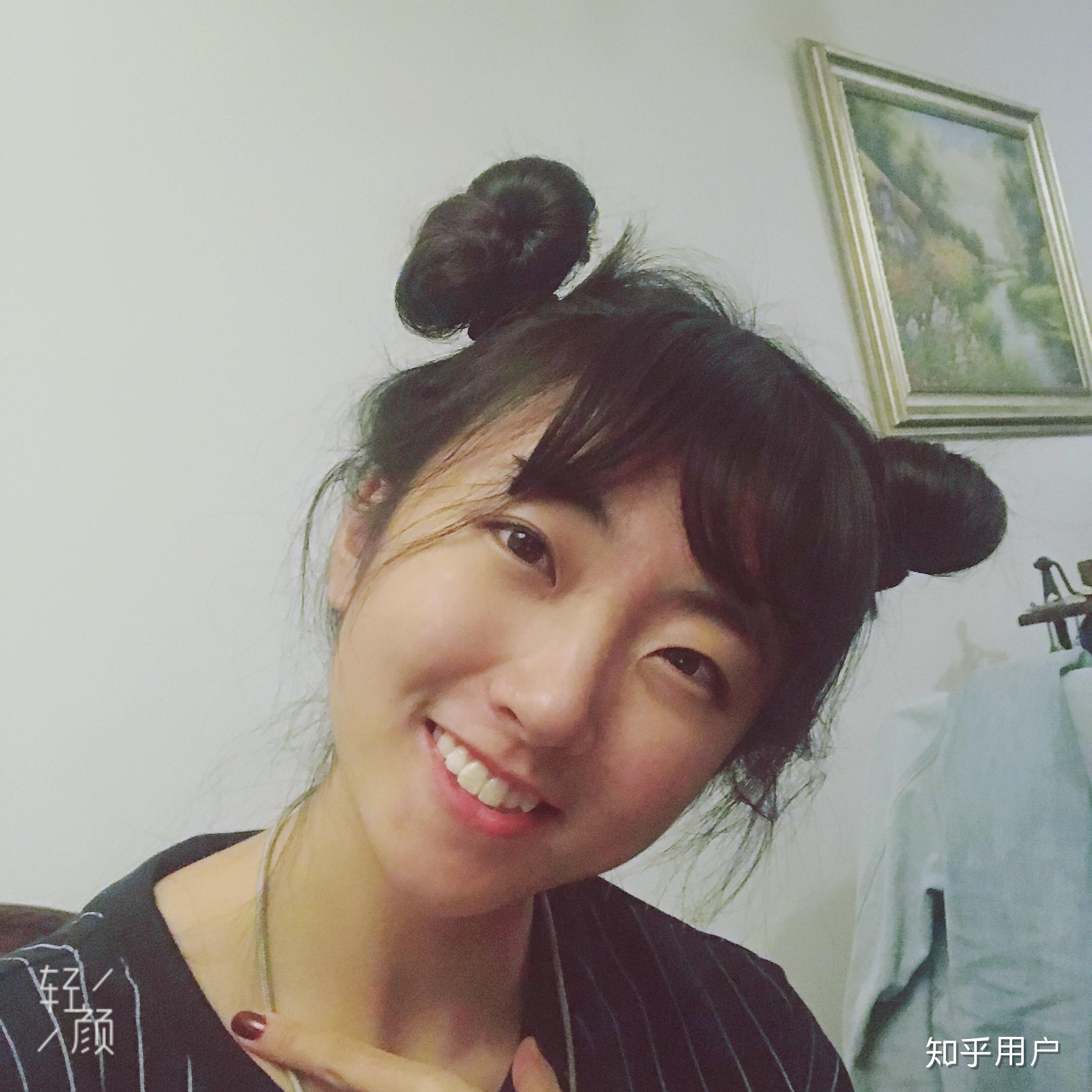 一个人同时长有虎牙和兔牙是什么样的感受