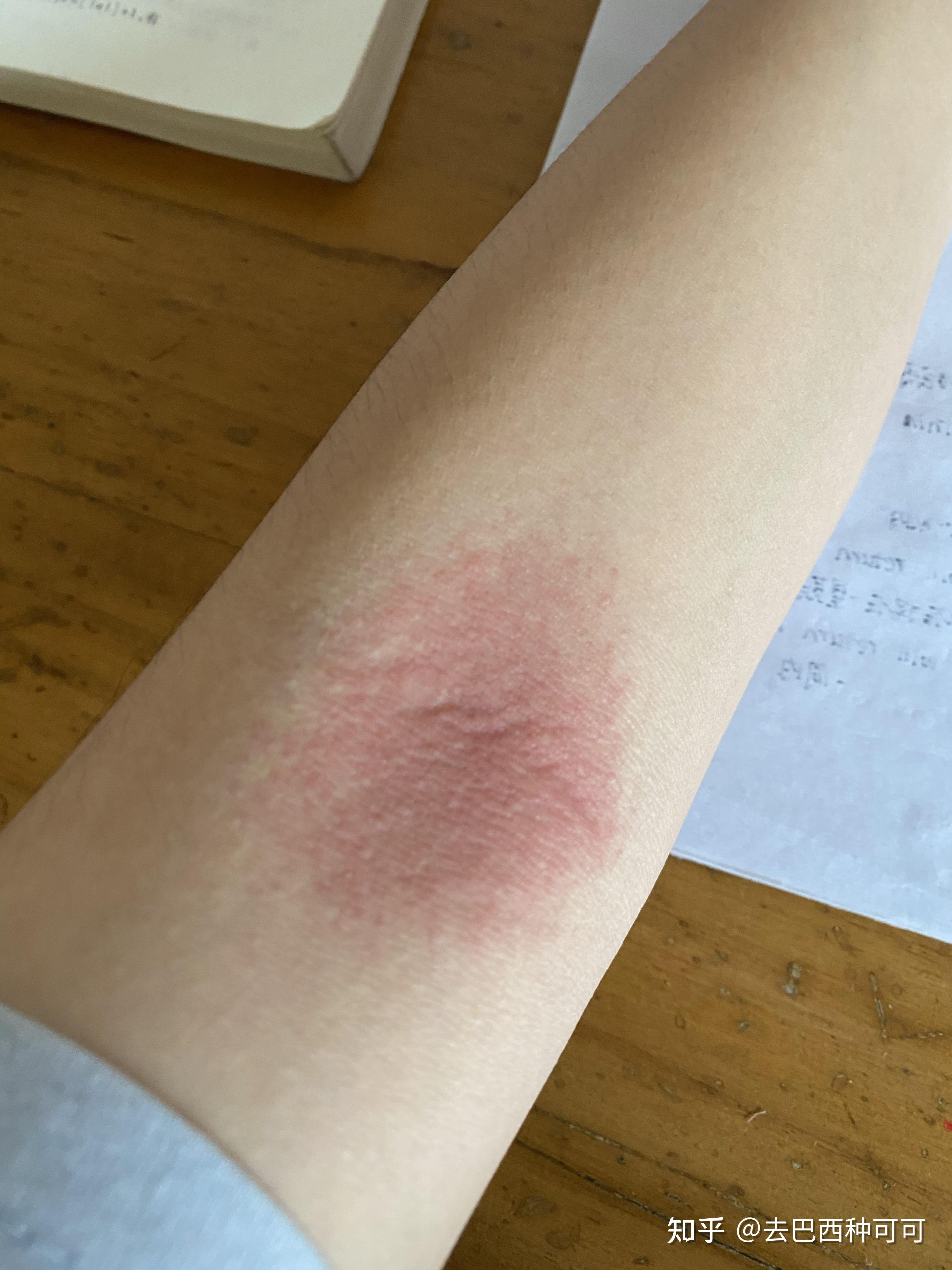 拍打手肘窝真的可以排毒吗? ?