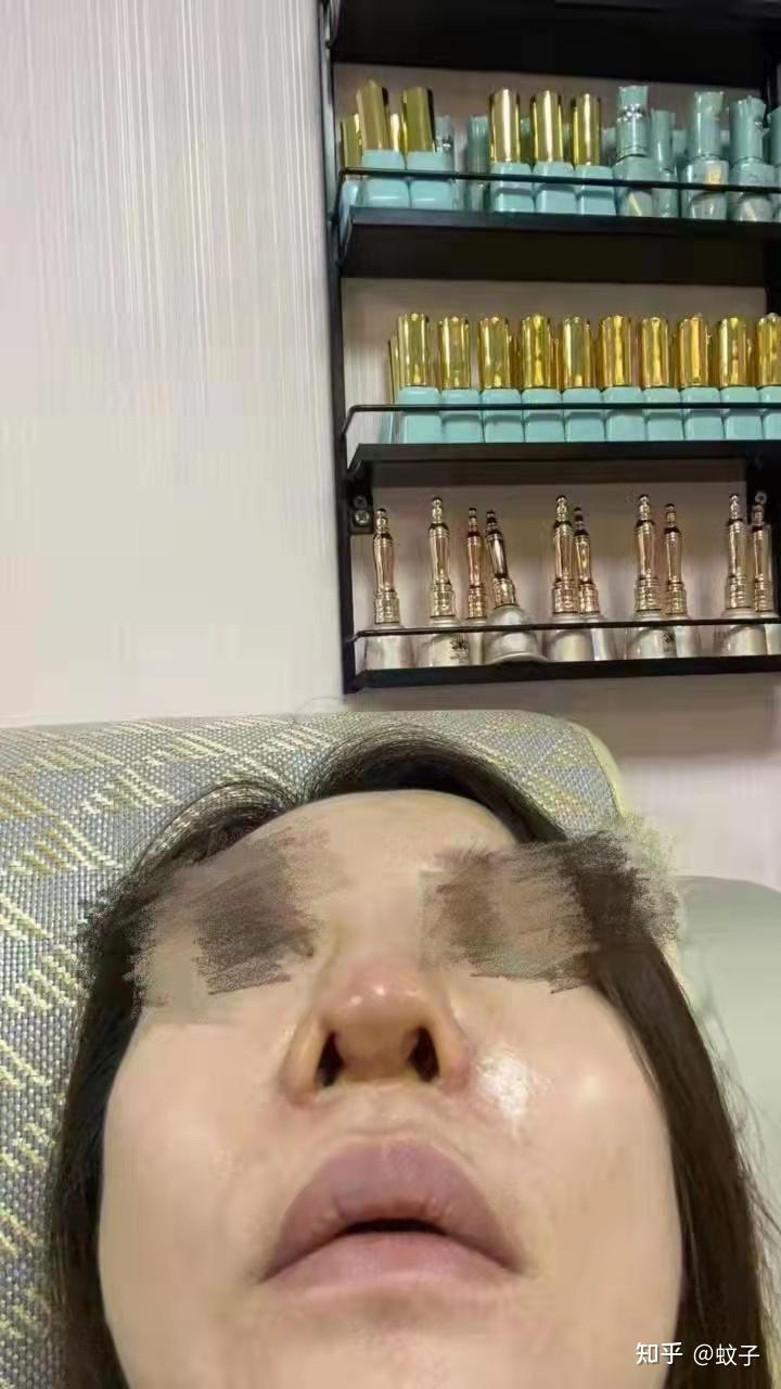 整容不成反毁容!真相的背后谁来为“美”买单? - 知乎