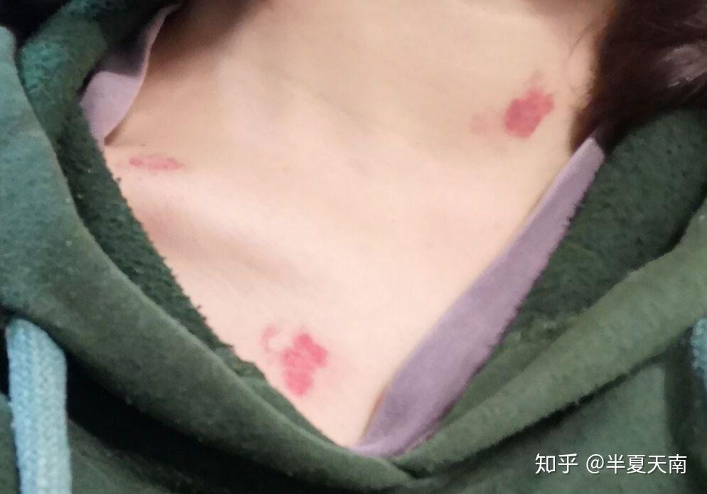 给女朋友种草莓要吸多久