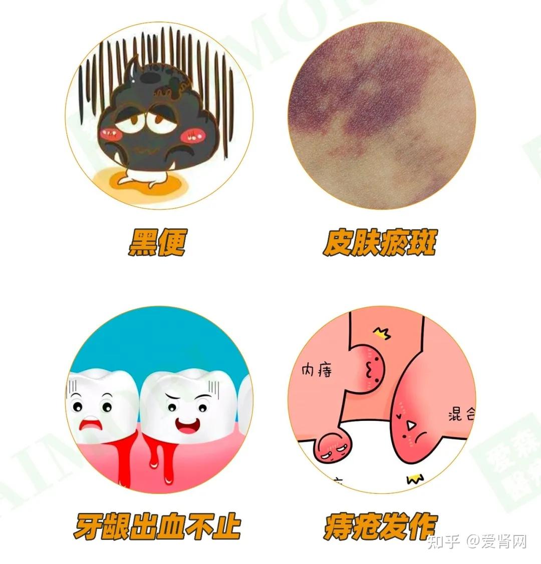 被透析肾友忽视的出血问题，危害太大，赶紧关注！ - 知乎