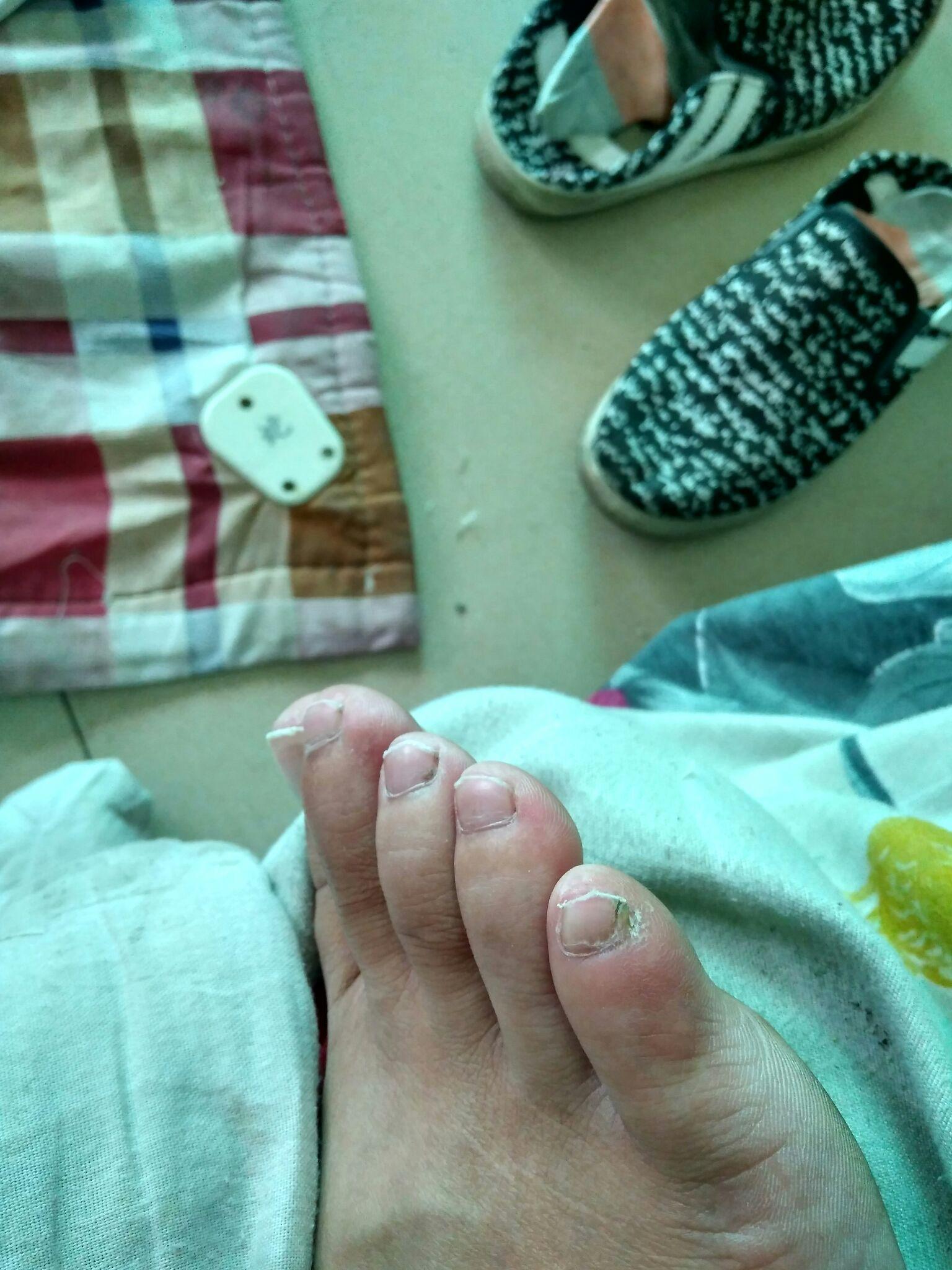 小脚趾复趾的汉人到底是不是纯正的汉族人呢?