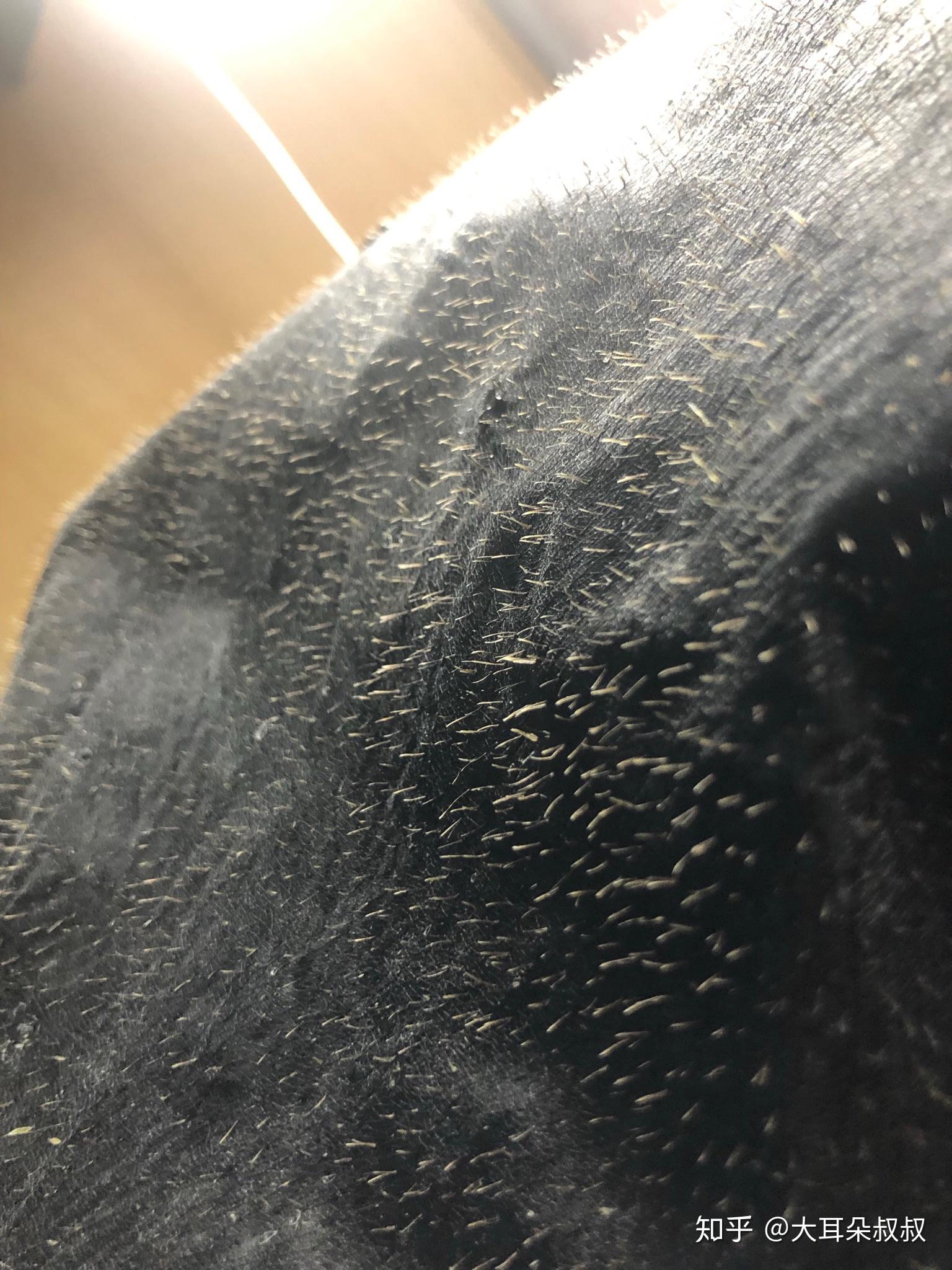 我背部毛孔粗大而且好像有的毛孔里不止一根汗毛的样子怎么办