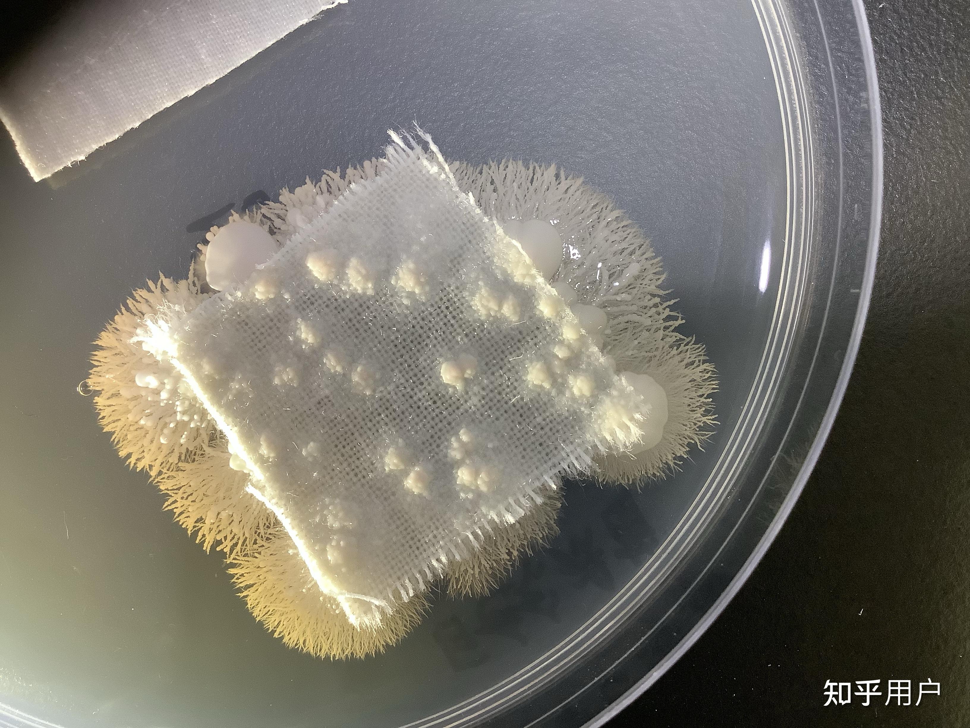 造成脚气的真菌,如果放在培养皿上培养,会变成蘑菇或肉眼可见的东西吗