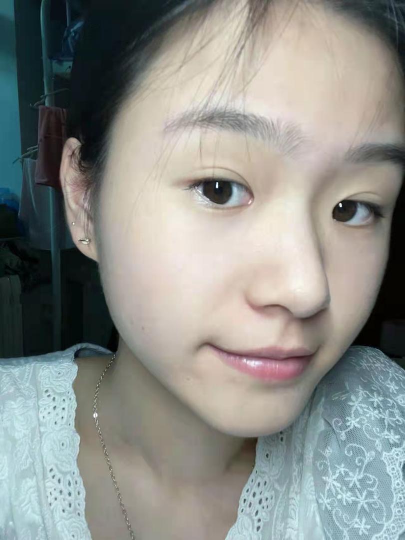 请问全身皮肤偏黄脸色暗黄看着气色很不好是怎么回事