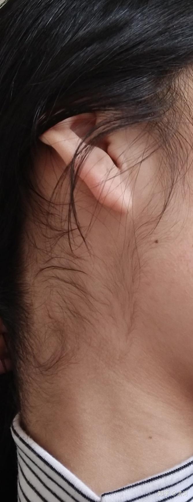 女生鬓角头发多且浓厚是一种怎么样的体验