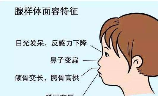 怎么看小孩子有没有地包天 v2-f929936fe2447863b8cda433363e336d_1440w.jpg?source=172ae18b