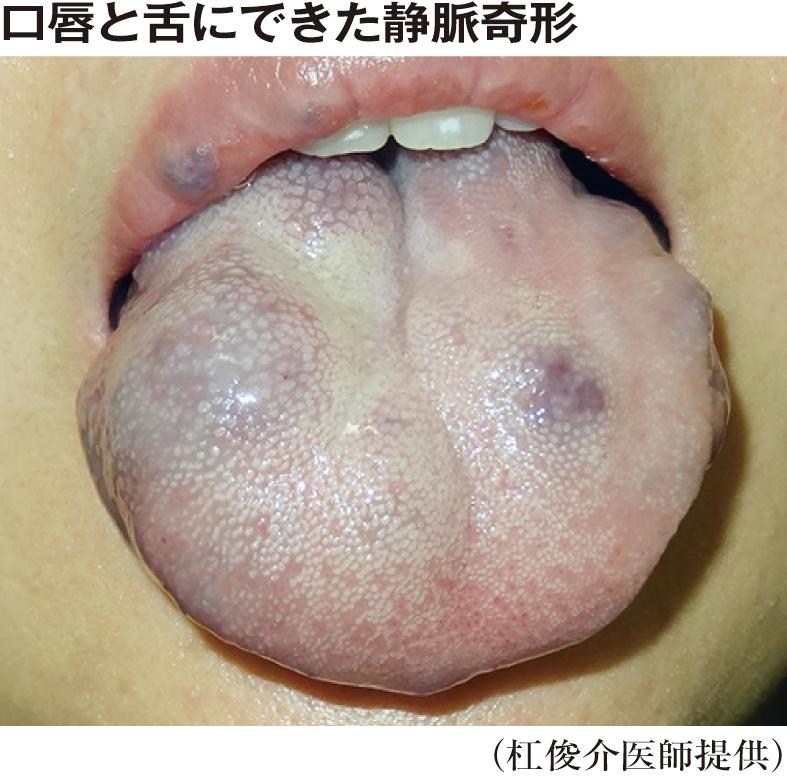 v2-f93056ad0b3bbf999aeed3e44f31dc77_1440w.jpg?source=172ae18b