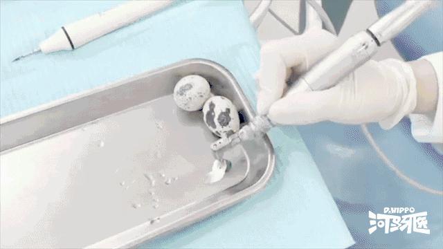 洗牙的过程是怎样的？洗牙后有哪些需要注意的？ 知乎 