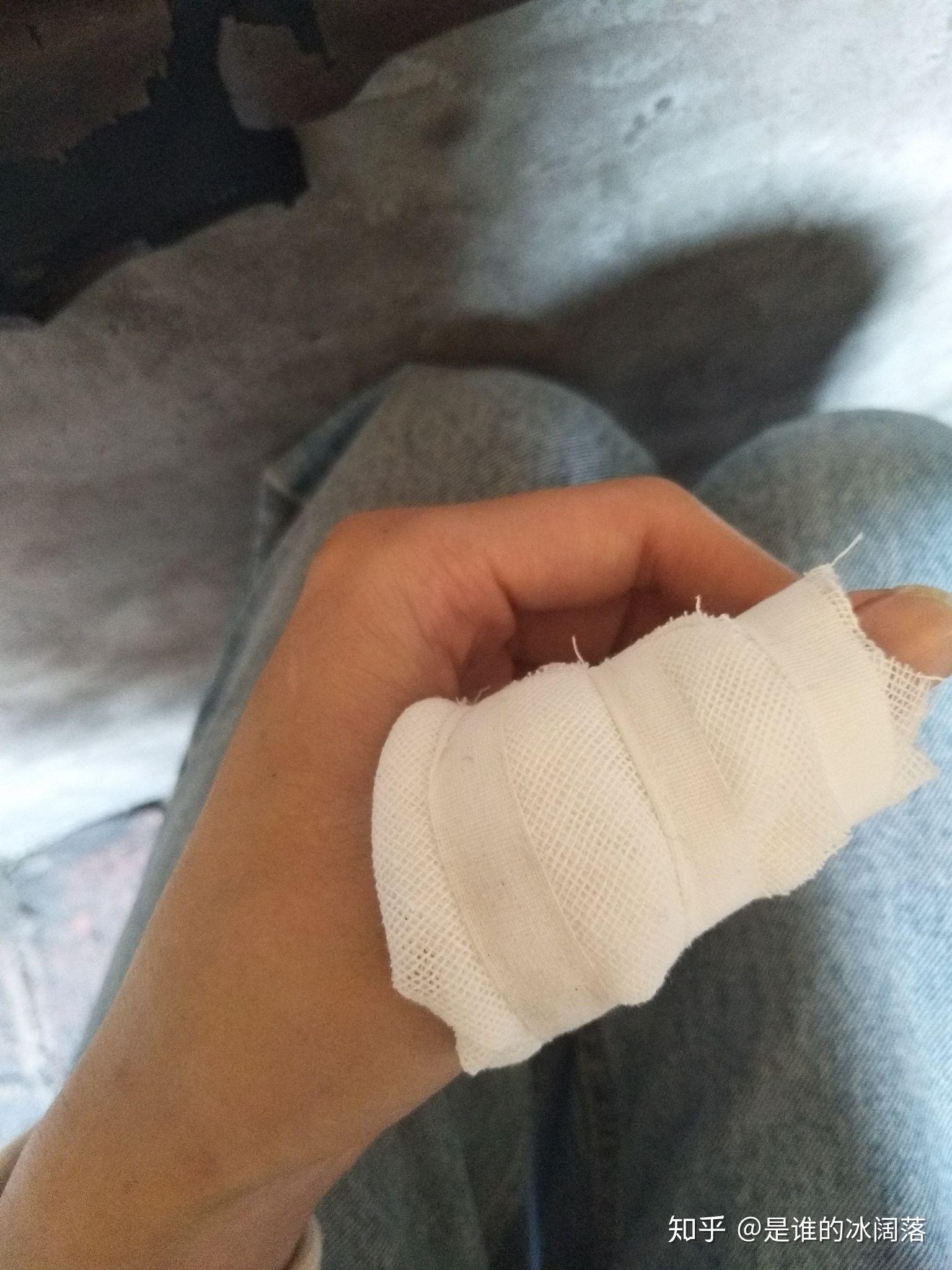 手被刀切了个深口子应该怎么处理