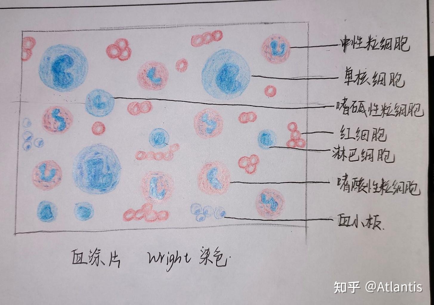 有没有红蓝铅笔血涂片的手绘图