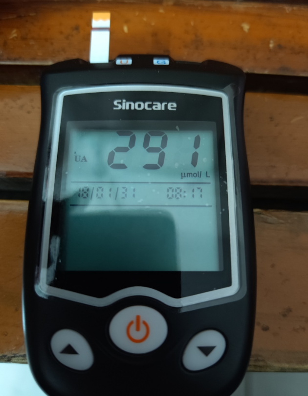 大家知道尿酸检测仪价格是多少吗