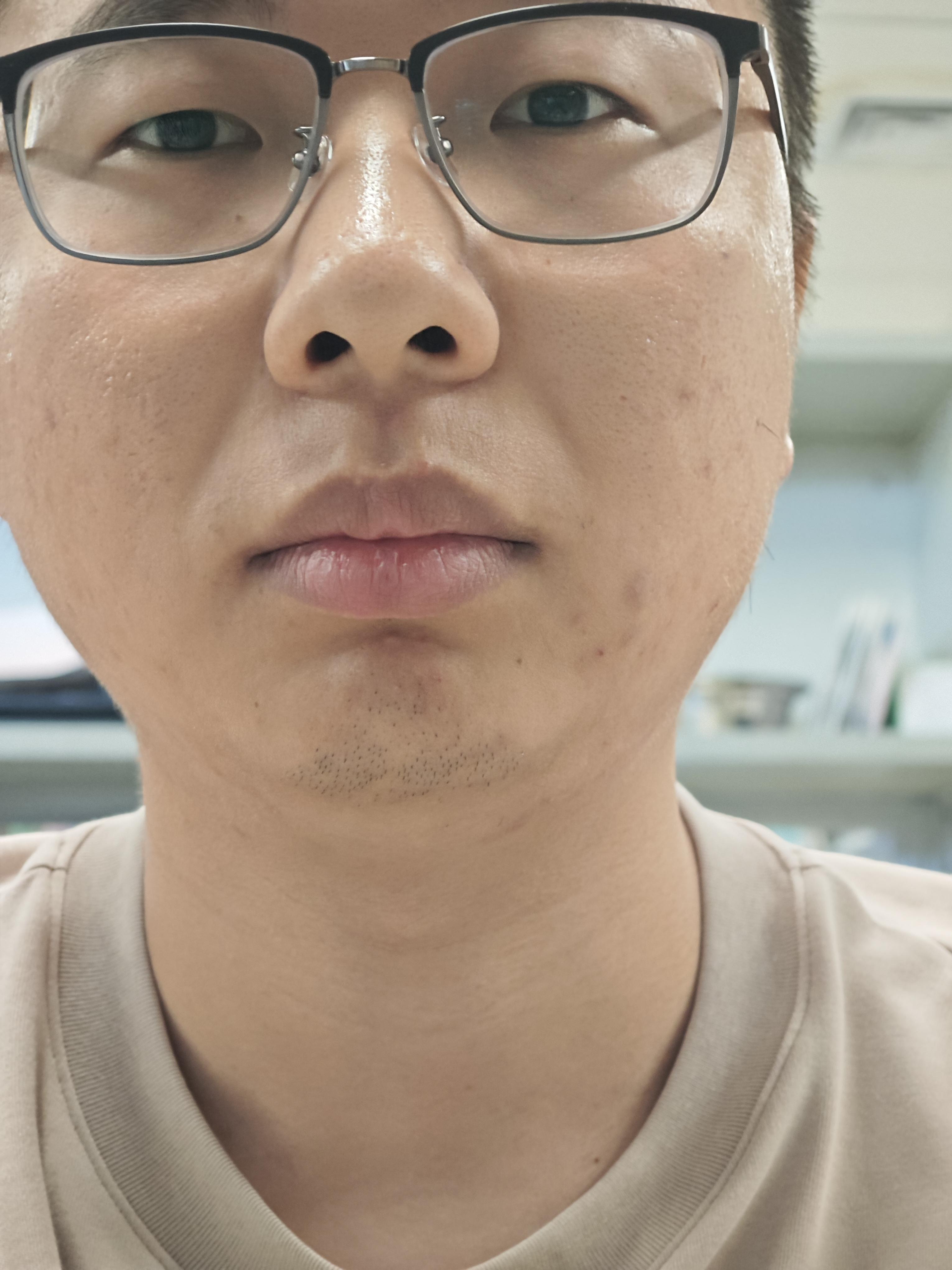 有没有长得丑的男生照片分享一下我想知道什么样算丑