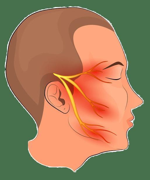 听神经瘤影响患者颅内神经临床表现特点