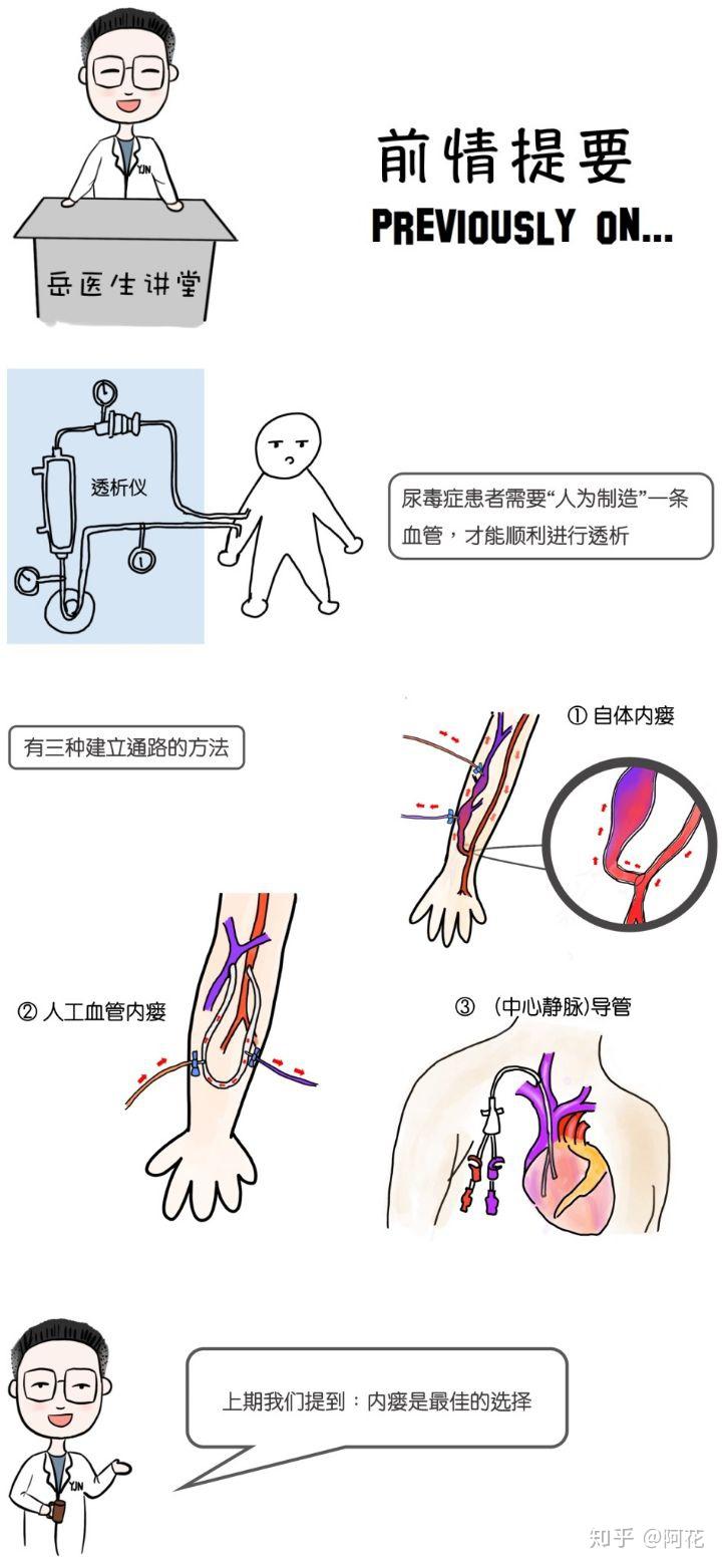 造瘘过程模板图片