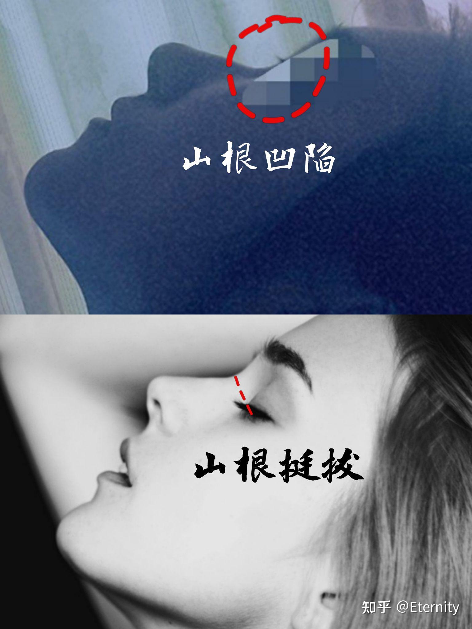 鼻子高但是山根低是什么样? - 知乎