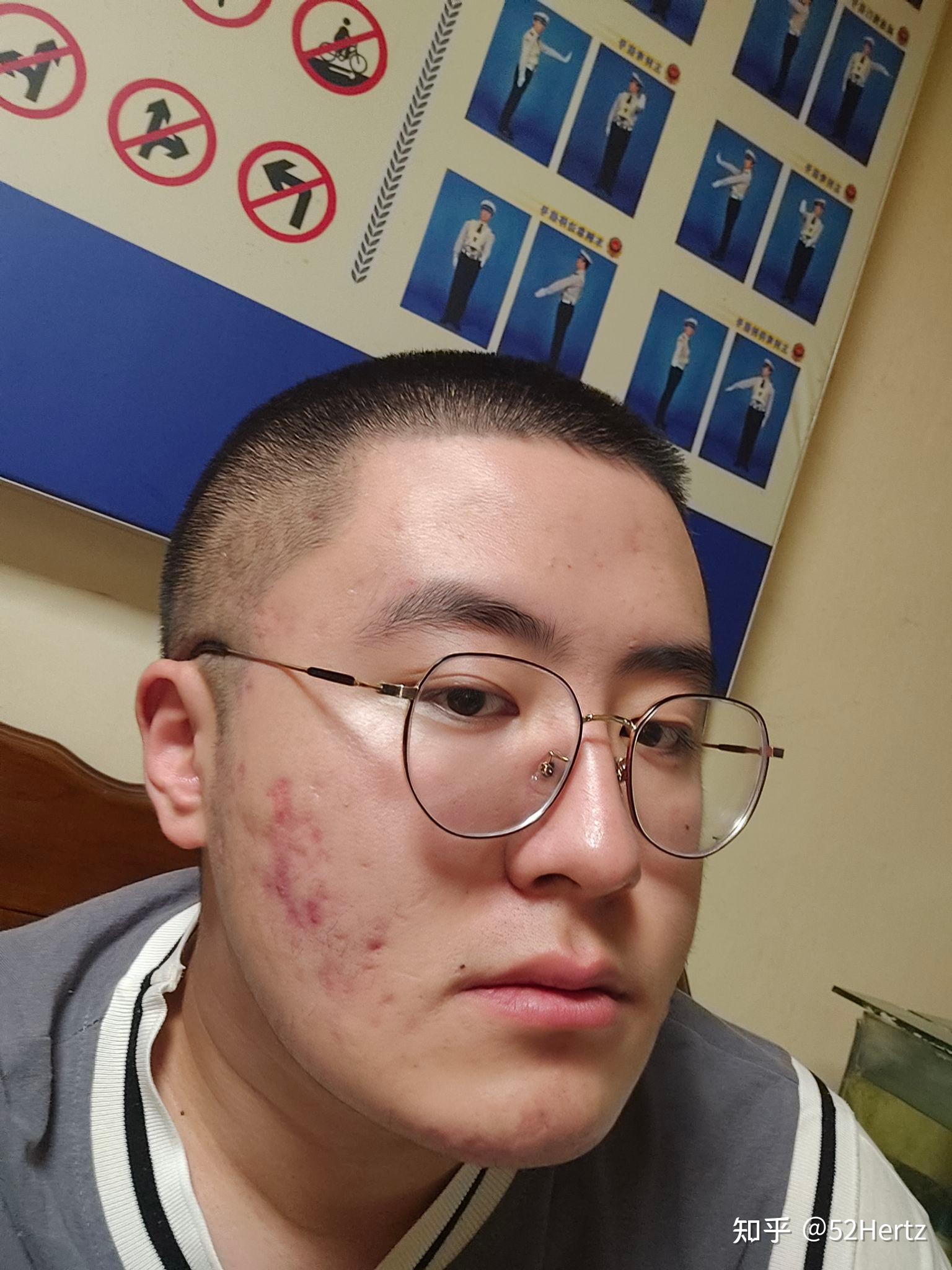 男生寸头可以有多丑