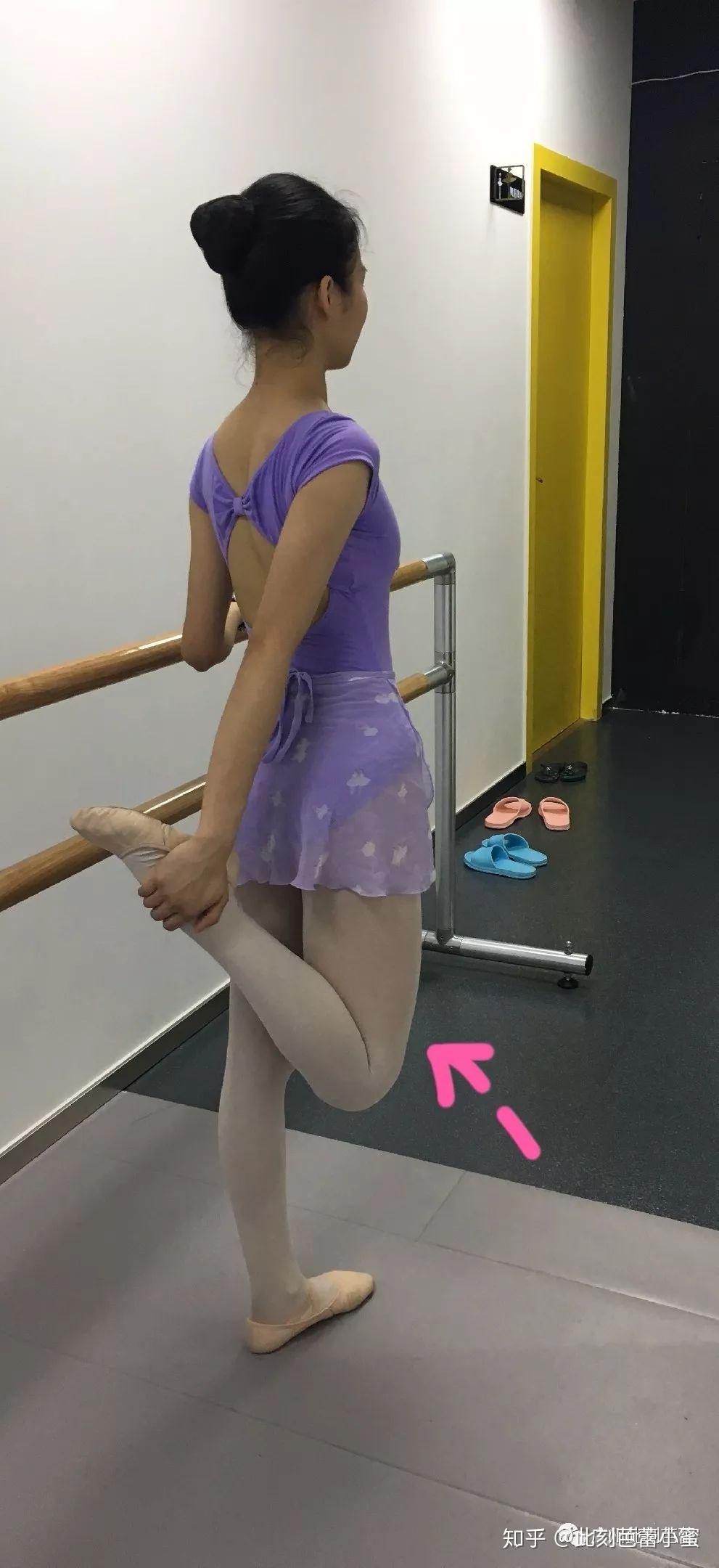 这样的肌肉腿还有救吗本人舞蹈生