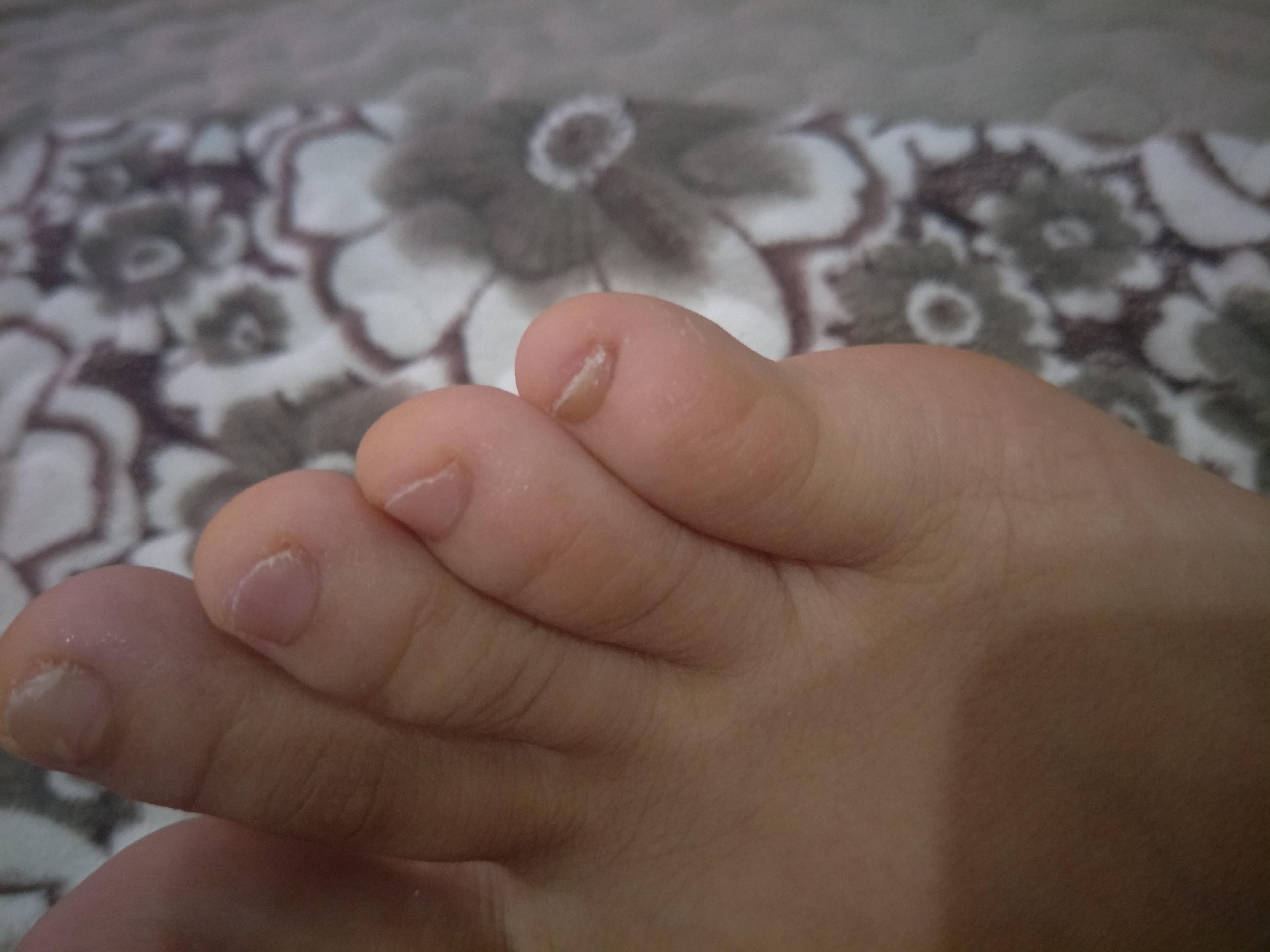 世界上最小的脚丫子图片