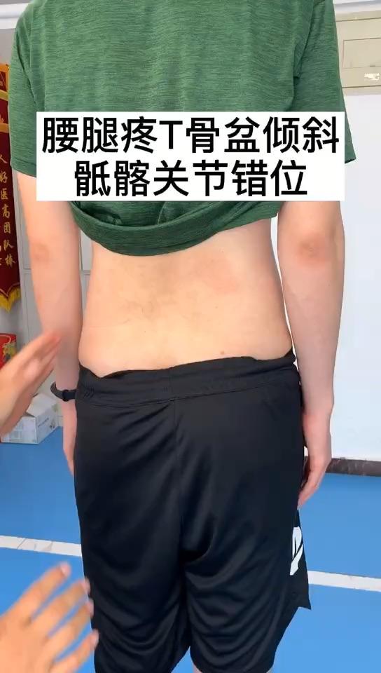 腰痛腰骶疼痛一定要检查骨盆和骶髂关节