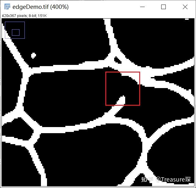 ImageJ实用教程——边缘检测图像分割(案例分析篇) - 知乎