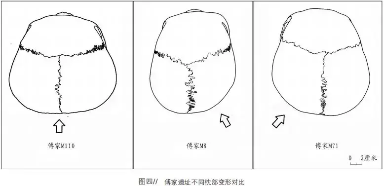 究竟是什么神秘力量,让中国孩子集体扁了头? - 知乎