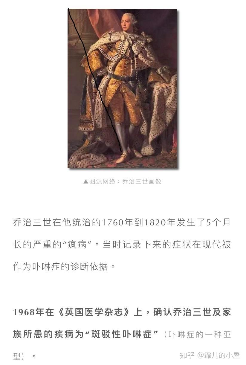 吸血鬼和僵尸真的存在吗？传说也是来源于生活- 知乎