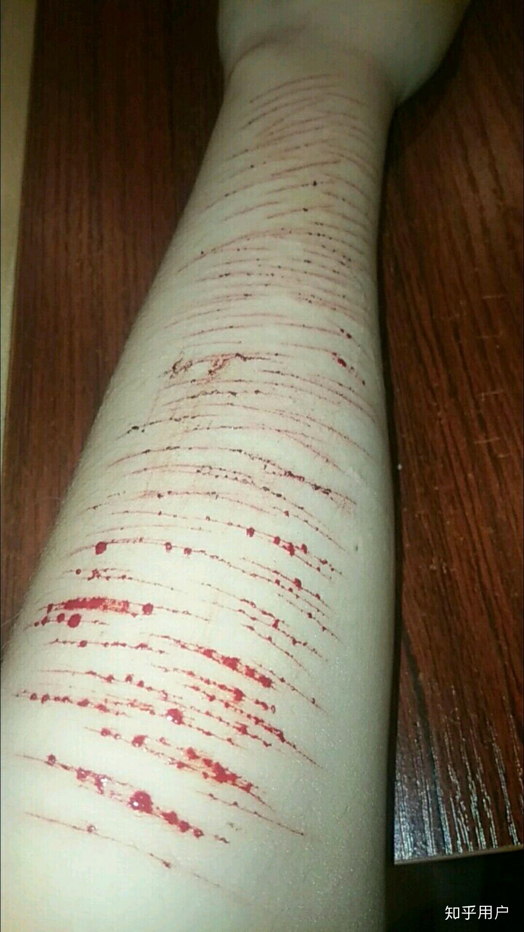 自残属于什么心理?